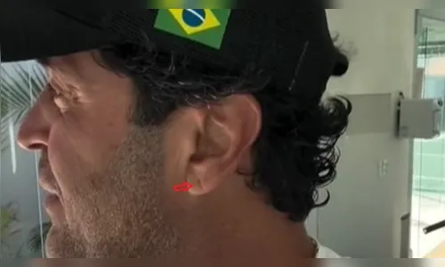 Após morte de Maderite, médicos alertam para dobra na orelha como sinal de risco; entenda