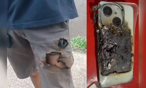 Morador escapa de ataque de cães no PR após celular explodir com mordida