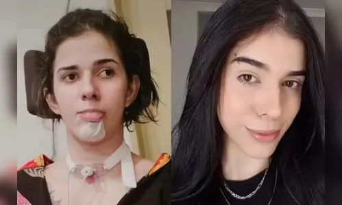 Caso Thaís Medeiros completa três anos após reação alérgica grave; Veja o vídeo