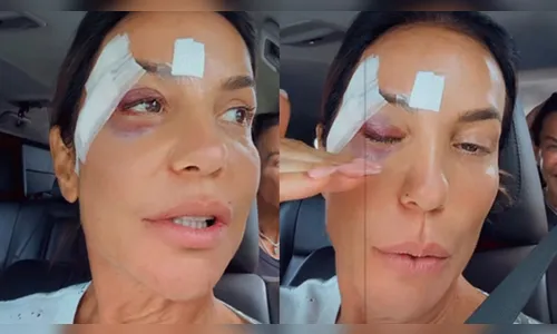 Ivete Sangalo detalha diagnóstico dado por médicos após desmaio e internação