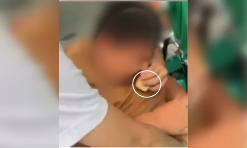 Jovem com 'síndrome da fome' é forçado a comer 7 fatias de bolo em escola no CE