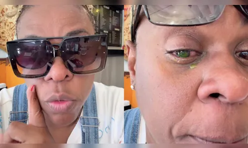 Cacau Protásio tem comprometimento da visão após dor intensa; entenda