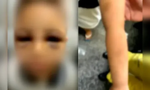 Homem é preso após espancar filho autista para “não virar bandido”