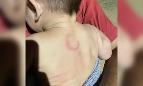 Homem é preso por espancar filho de apenas 4 meses