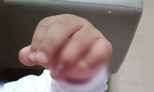 Família será indenizada em R$ 10 mil após criança se ferir em brinquedo público de Londrina