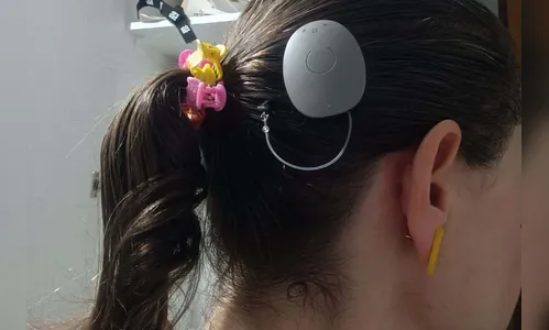 Paraná assume liderança nacional em implantes de correção auditiva pelo SUS