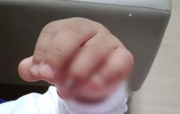 Família será indenizada em R$ 10 mil após criança se ferir em brinquedo público de Londrina