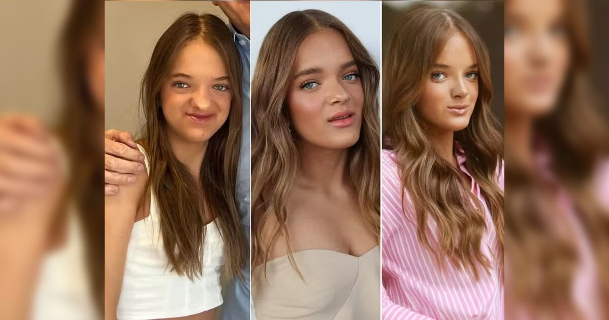 Confira a evolução de Rafa Justus após segunda cirurgia no nariz; veja fotos