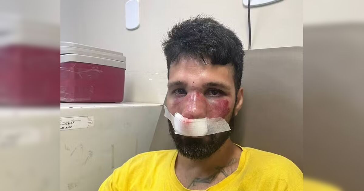 DJ é espancado no dia do próprio aniversário após ser confundido com ladrão