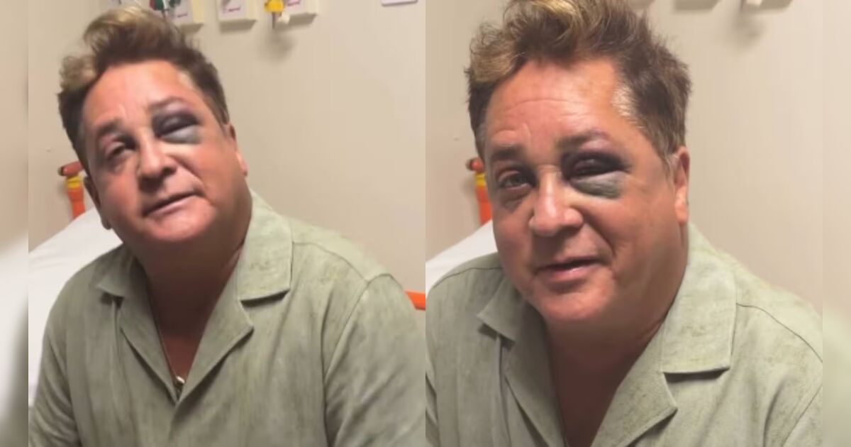 Leonardo surge inchado, de olho roxo e preocupa fãs; veja o que aconteceu