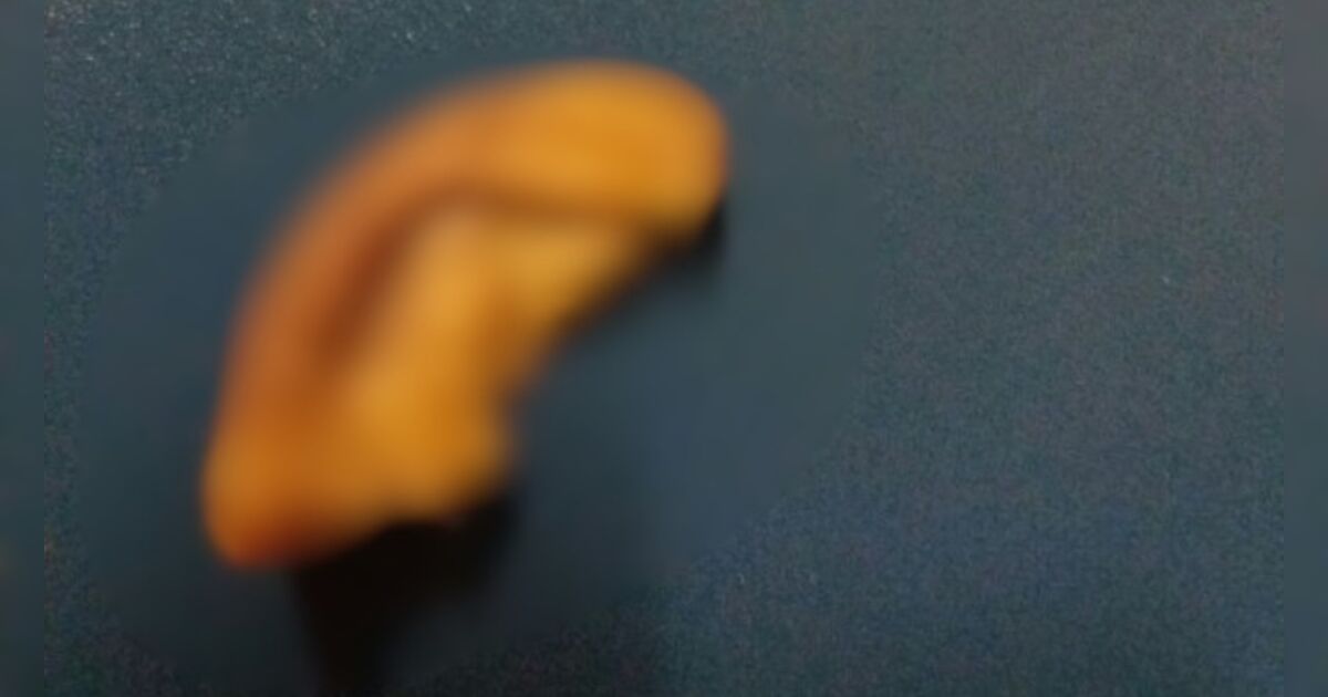 Homem tem parte da orelha arrancada por mordida após defender mulher em briga