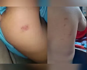 Mãe coloca gravador na mochila de filho e professora é afastada por maus-tratos