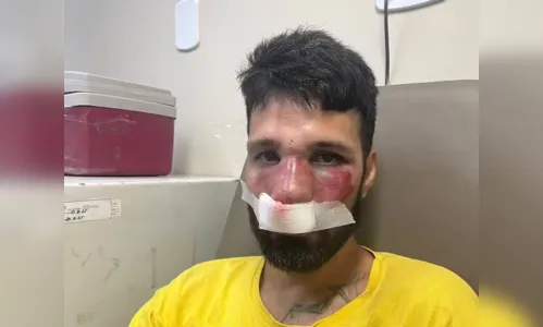 DJ é espancado no dia do próprio aniversário após ser confundido com ladrão