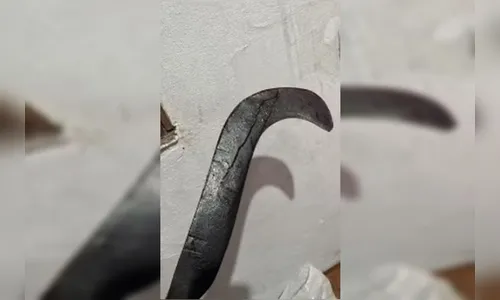Homem é preso após decepar mão de ex-namorada com foice