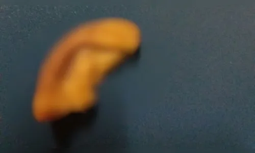 Homem tem parte da orelha arrancada por mordida após defender mulher em briga