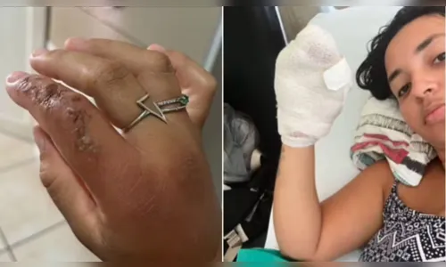 Mãe quase perde a mão após ser mordida pelo filho durante convulsão; veja vídeo