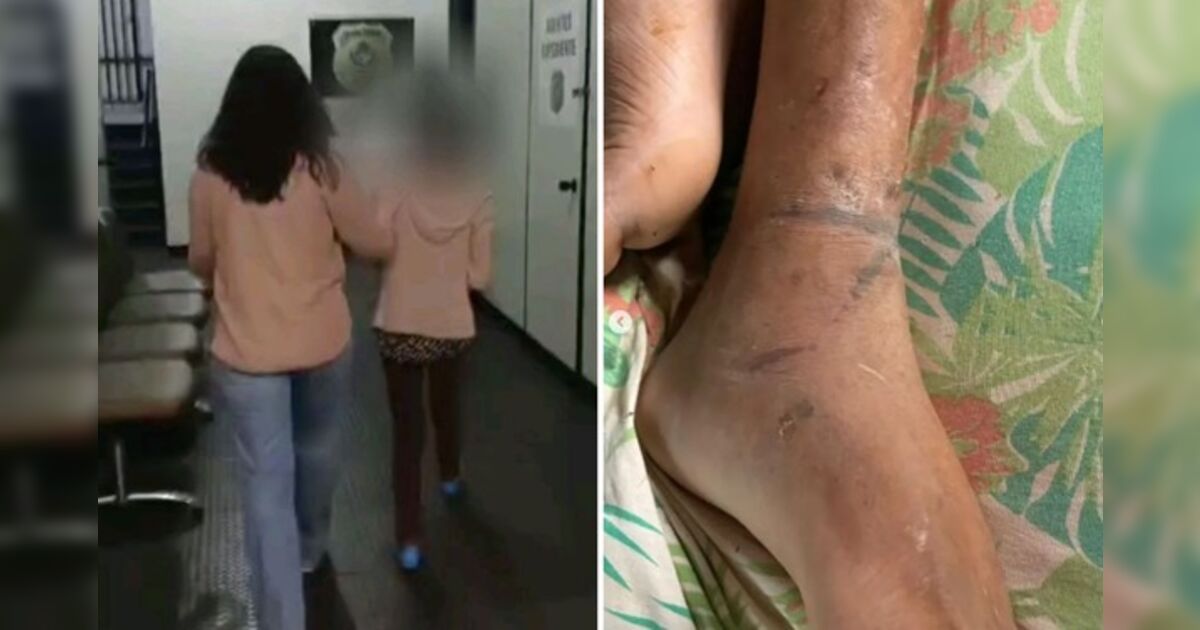 Mãe é presa por torturar e acorrentar filho que sofreu três AVCs
