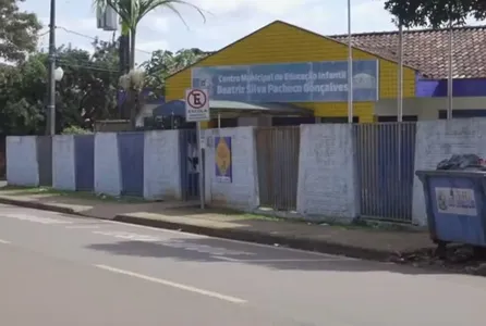 O bebê teve aproximadamente 18% do corpo atingido por queimaduras