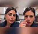 Alvo de comentários negativos, novo nariz de Simone Mendes ganha defesa de Gretchen