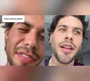Zé Felipe revela motivo de mudança no rosto e rebate especulações sobre plástica