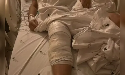 Idosa passa por cirurgia e ao acordar percebe que médicos implantaram prótese em joelho errado no PR