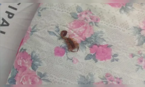 Paciente internado é picado por escorpião dentro de hospital em Foz do Iguaçu