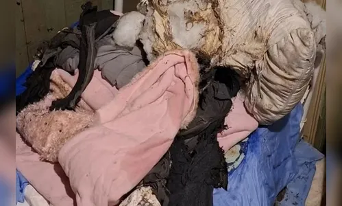 Homem acamado tem 82% do corpo queimado após ter a cama incendiada por criminosos em SC