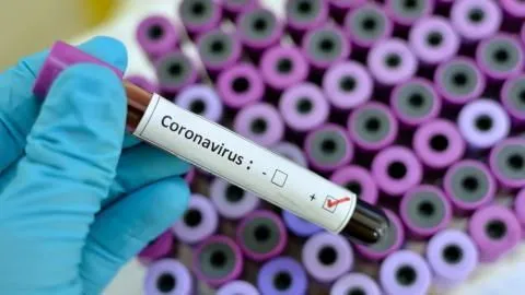 Arapongas registra 44 casos do novo coronavírus