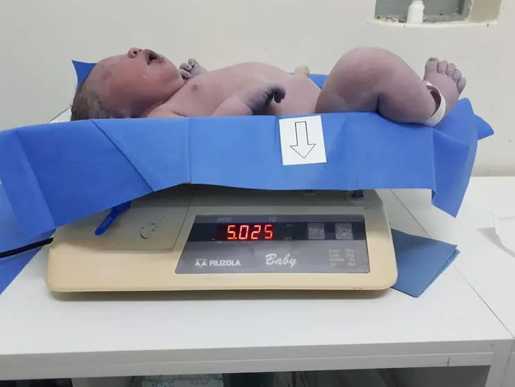 Bebê nasce com mais de 5 kg em Cascavel