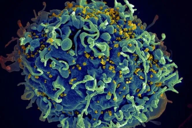Pesquisadores da Unifesp podem ter descoberto cura da AIDS