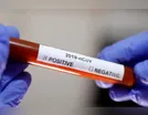 América do Sul como novo epicentro da pandemia não surpreende médicos brasileiros