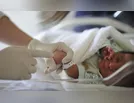 Cirurgias pediátricas de cardiopatia congênita têm déficit de 50%