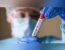 São João do Ivaí registra mais três casos do novo coronavírus