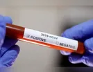 Ivaiporã tem mais 10 pacientes confirmados com covid-19