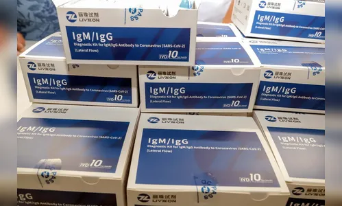 Apucarana já aplicou 280 testes rápidos para Covid-19