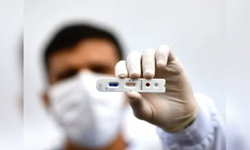 Paraná confirma 3.331 casos positivos e 156 mortes pela Covid-19