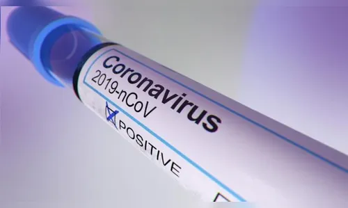 Londrina registra mais 31 novos casos de Covid-19