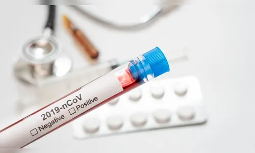 Ivaiporã tem mais um caso confirmado de Covid-19