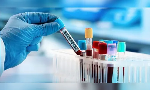 Nove pessoas da mesma família testam positivo para Covid-19 em Cruzmaltina