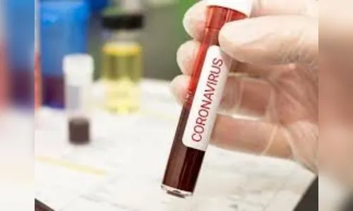Jandaia do Sul confirma mais dois casos de Covid-19