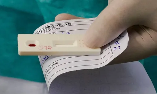 Informativo Covid-19 de Ivaiporã terá mudanças a partir desta quarta