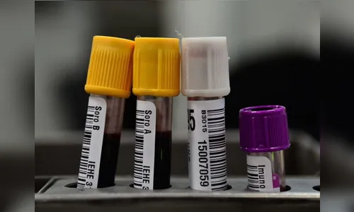 Paraná confirma mais 851 casos de coronavírus e 17 mortes