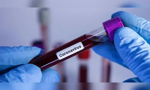 Rio Branco do Ivaí, Lidianópolis e Sabáudia tem novos casos de Covid