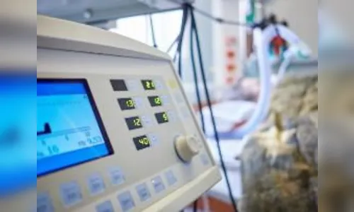 TCE fiscaliza compra de 335 respiradores para tratamento da Covid-19