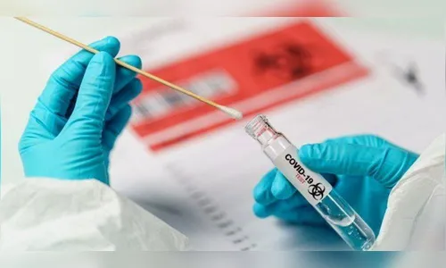 Mais oito pessoas testam positivo para covid-19 em Ivaiporã