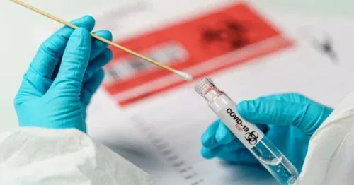 Mais oito pessoas testam positivo para covid-19 em Ivaiporã