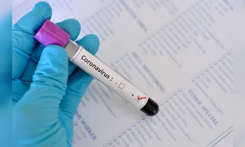 Apucarana tem mais um óbito e casos de Covid chegam a 251