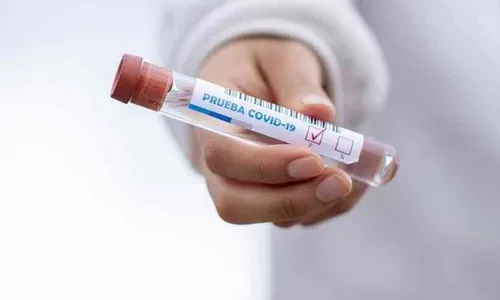 Londrina confirma mais 61 novos casos de Covid-19