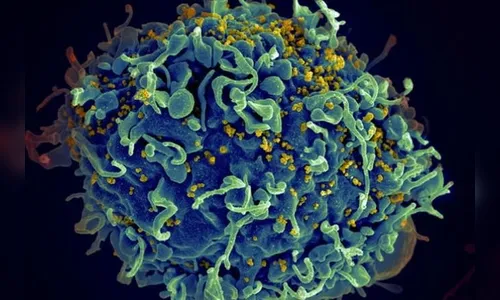 Pesquisadores da Unifesp podem ter descoberto cura da AIDS