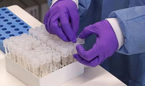 Lunardelli registra mais dois diagnósticos positivos de coronavírus